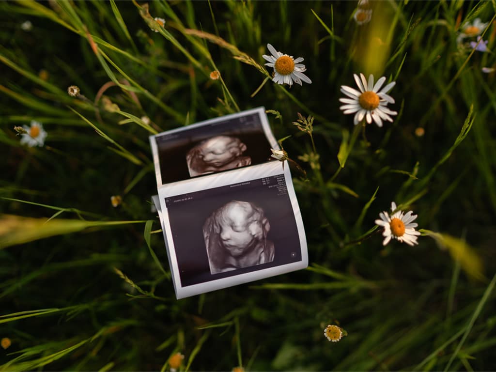 Fotografie 6